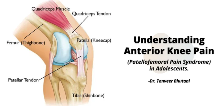 EVA-Ortho-Understanding-Anterior-Knee-Pain