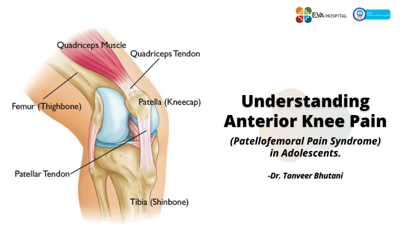 anterior knee pain