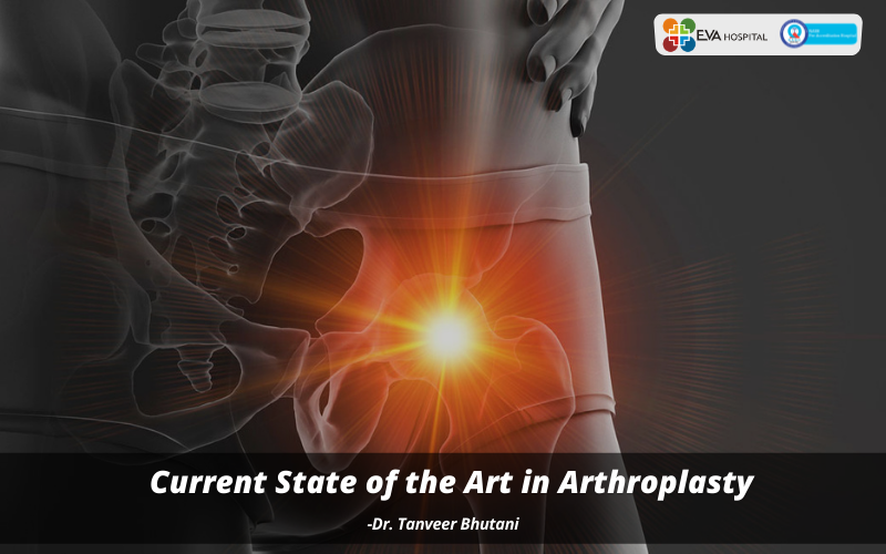 art in arthroplasty