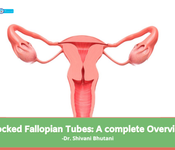 Blocked-Fallopian-Tubes-A-complete-Overview