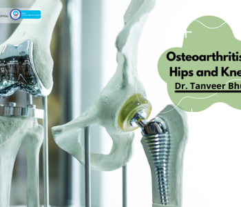 Eva-Osteoarthritis-of-Hips-and-Knees-2