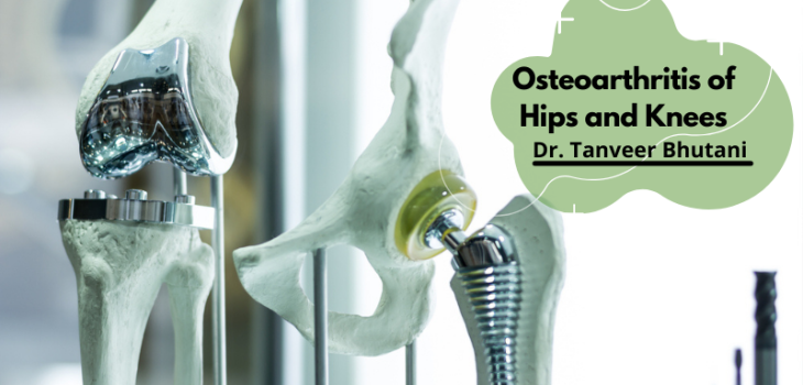 Eva-Osteoarthritis-of-Hips-and-Knees