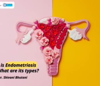 Eva-What-is-Endometriosis-and-What-are-its-types
