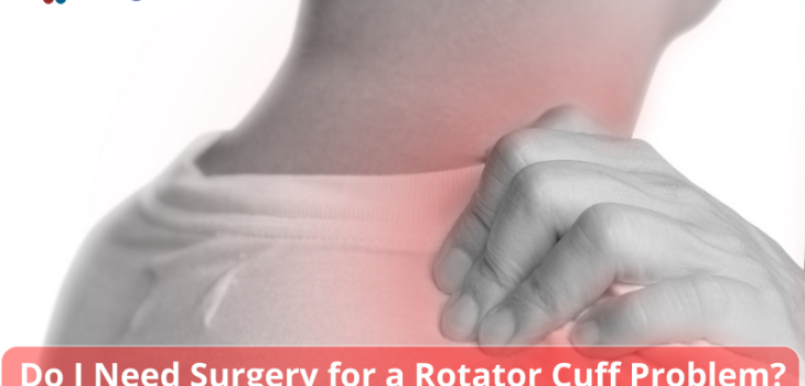 Do-I-Need-Surgery-for-a-Rotator-Cuff-Problem