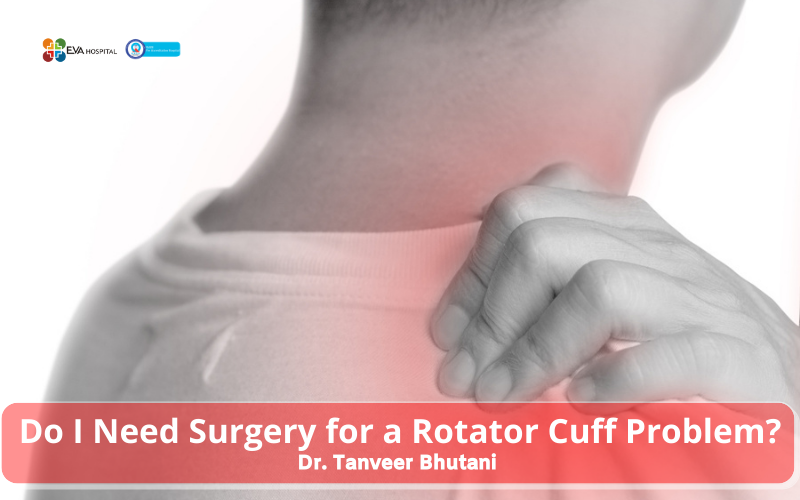 Do I Need Surgery for a Rotator Cuff Problem?