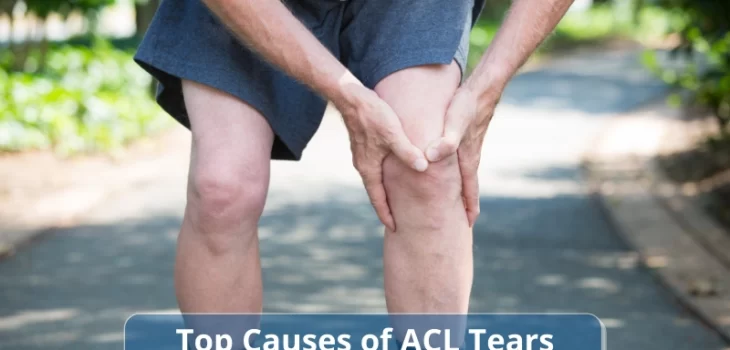 EvaTop-Causes-of-ACL-Tears