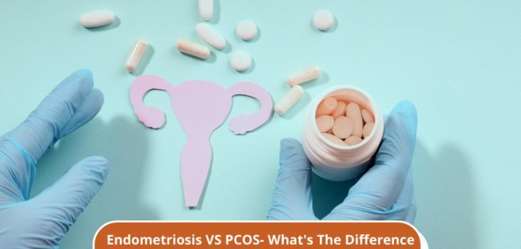 ometriosis-VS-PCOS-Whats-The-Difference