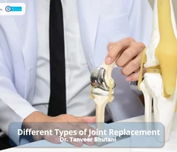 Different-type-of-Joint-replacement-1