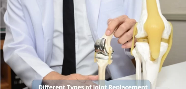 Different-type-of-Joint-replacement