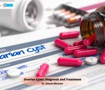 Ovarian Cysts: Diagnosis and Treatment