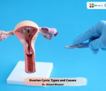 Ovarian-Cysts-Types-Cause.