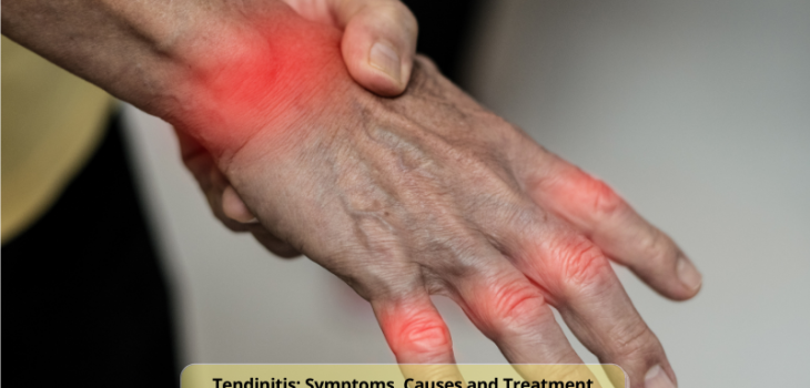 Tendinitis-Symptoms-Causes-and-Treatment