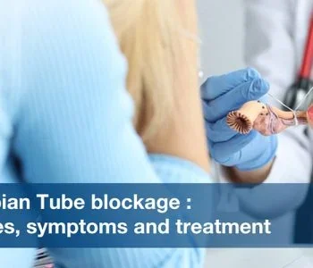 Fallopian Tube Blockage: Causes, Symptoms and Treatment