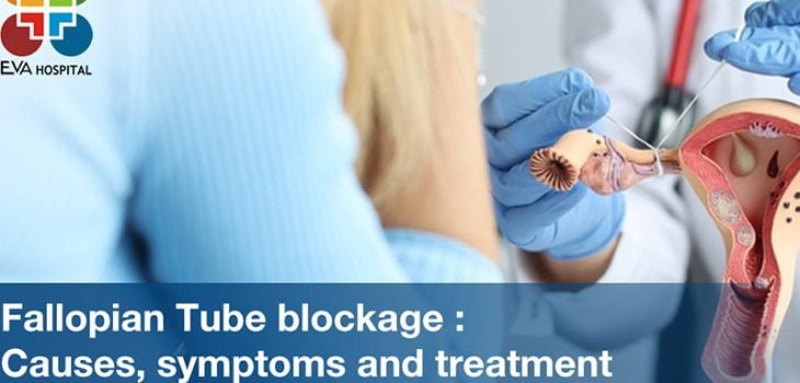Fallopian-Tube-Blockage--Causes,-Symptoms-and-Treatment