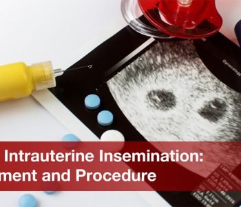 IUI-or-Intrauterine-Insemination--Treatment-and-Procedure