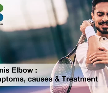 Tennis-Elbow-Symptoms-causes-treatment