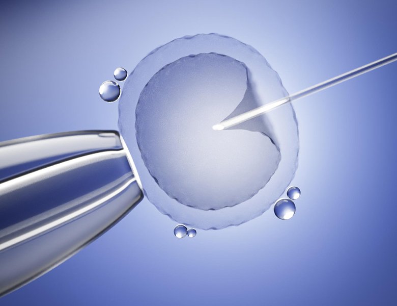 Treatment-Process-of-Artificial-Insemination
