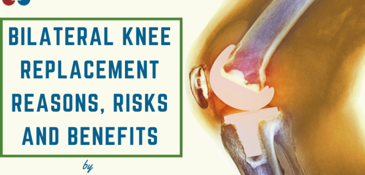 Bilateral-Knee-Replacement-Reasons-Risks-and-Benefits