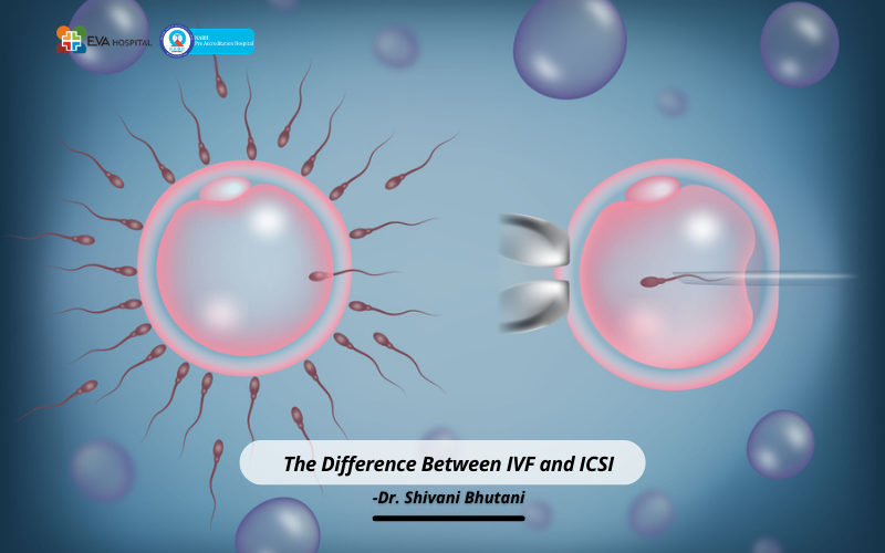 The Difference Between IVF vs ICSI