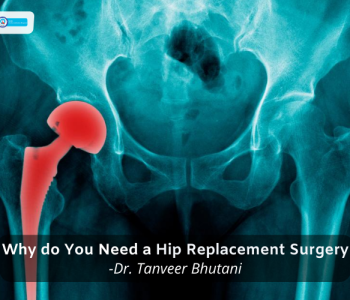 EVA-Why-u-need-a-hip-replacement-surgery