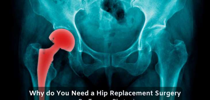 EVA-Why-u-need-a-hip-replacement-surgery