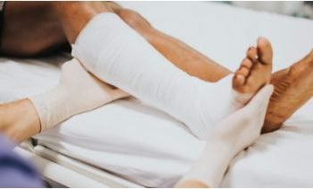 doctor-helping-patient-with-fractured-leg