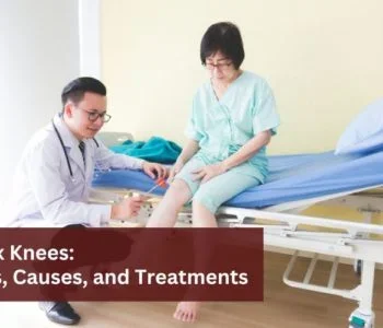 Knock-Knees-Types-Causes,-and-Treatments--Insights-by-Dr.Tanveer Bhutani