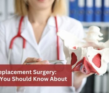 Hip-Replacement-Surgery-Facts-You-Should-Know-About