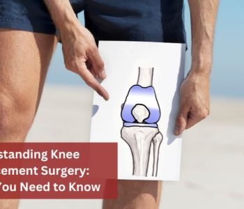 Understanding Knee Replacement Surgery: What You Need to Know
