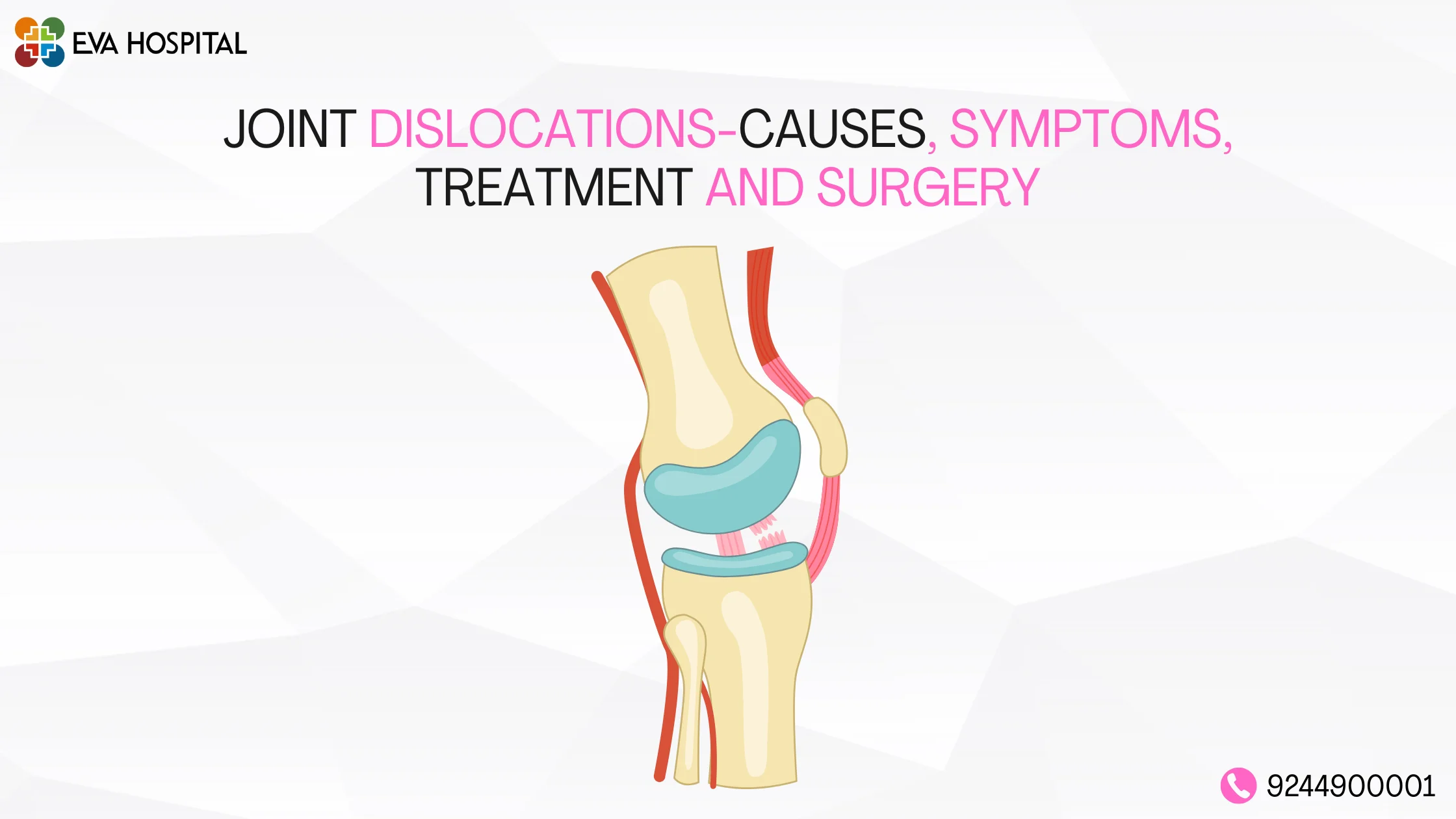 Joint Dislocations-Causes, symptoms, treatment and surgery (1)