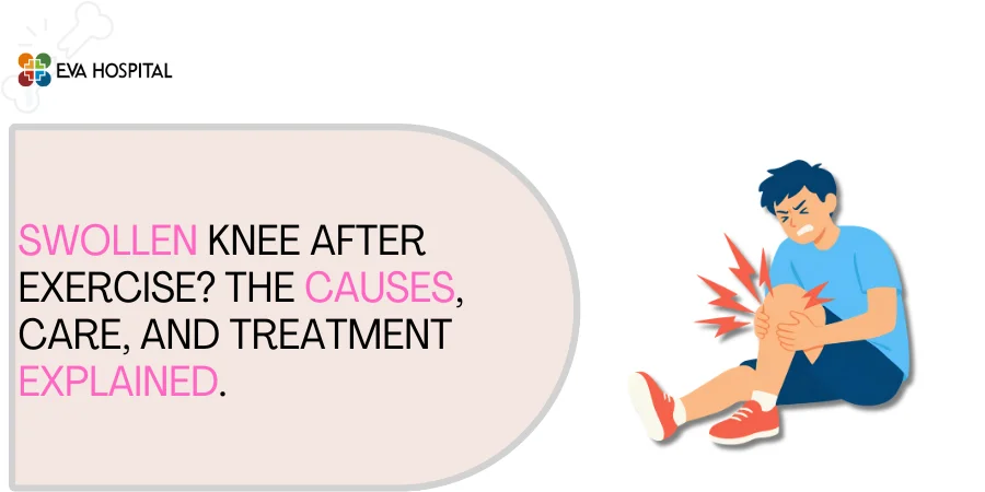 Swollen Knee After Exercise The causes, care, and treatment explained.